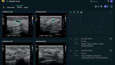 Breast scan analysis via See-Mode software