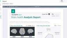 Sample report by Neurophet Aqua