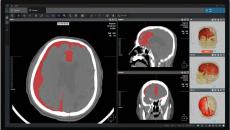 Interface of Coreline Soft's AVIEW Neuro CAD